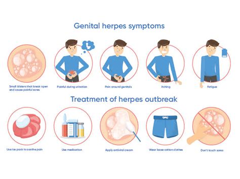 herpes get back to work its hermes commerci|herpes outbreak back to back.